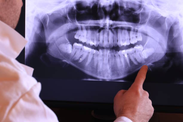 Best Emergency Dental Extractions in Constantine, MI