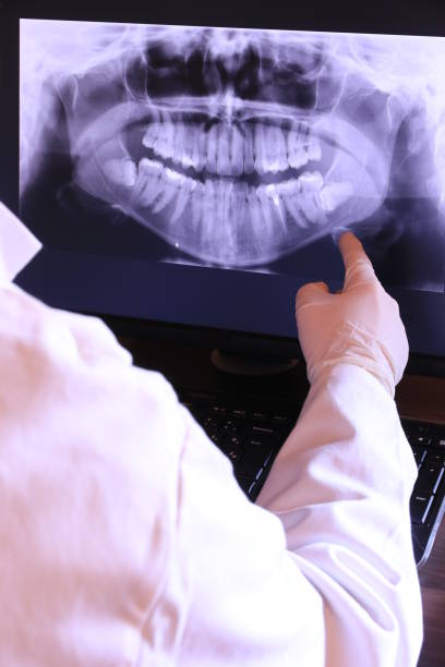 Best Emergency Dentist for Lost Fillings or Crowns in Constantine, MI