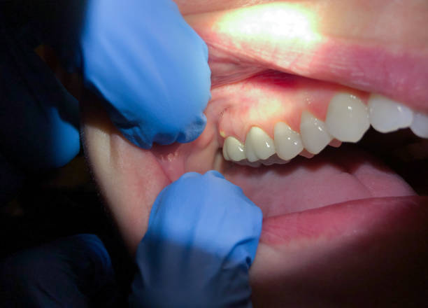 Best Emergency Cosmetic Dentistry in Constantine, MI