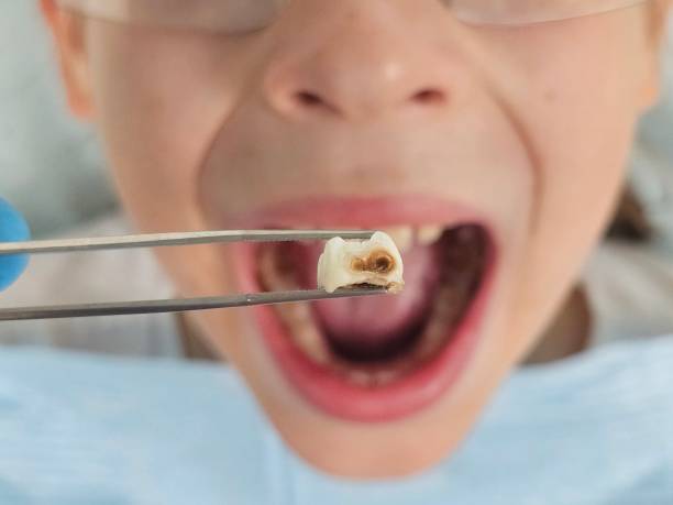 Best Emergency Dental Care for Abscessed Tooth in Constantine, MI